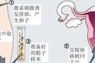 泰国试管婴儿技术为何在亚洲备受青睐？